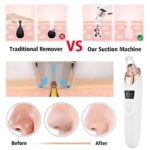Best Electric Blackhead Remover for Facial Pores